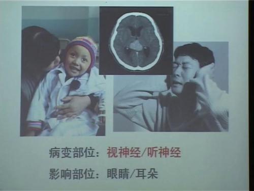 北师大版生物七下12.1《神经系统的组成》课堂教学视频实录-李红菊